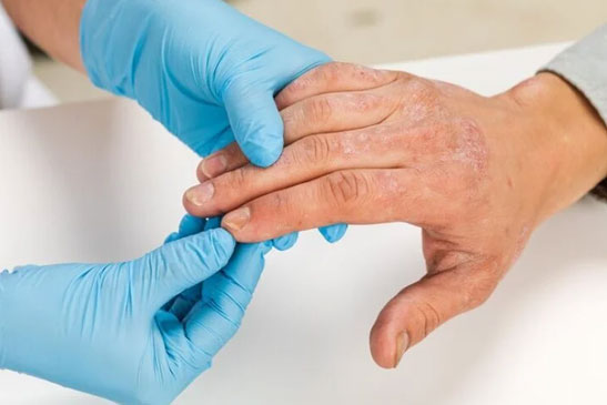 Allergy Services