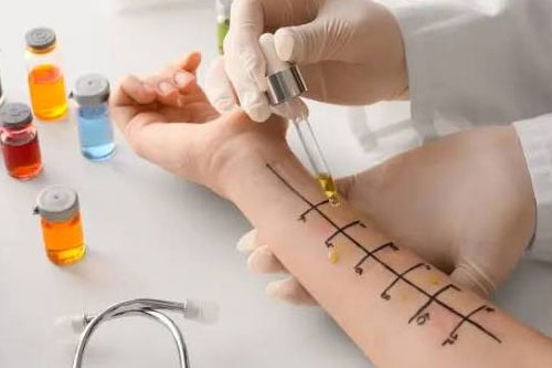 Allergy evaluation & diagnosis