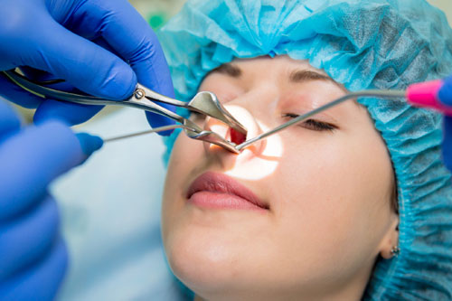 Nasal and sinus surgery