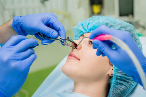 Other selected ENT surgical procedures