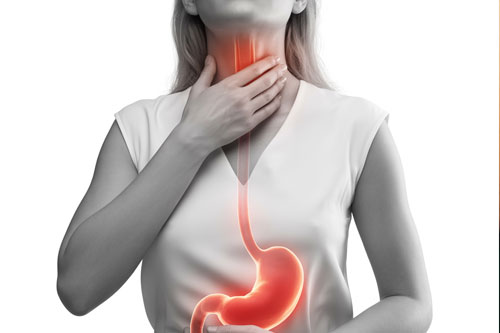 Laryngopharyngeal Reflux (LPR)